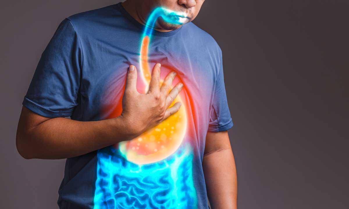 GERD[Acid Reflux]:Relevant Points About It !