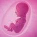 Oligohydraminos : Low amniotic fluid symptoms and signs